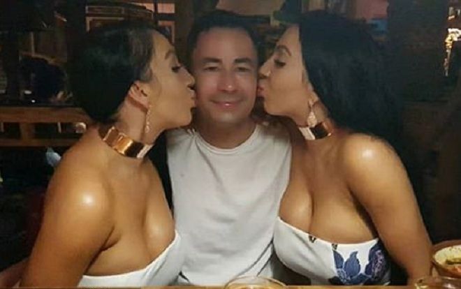 'Cặp sinh đôi giống nhau nhất thế giới' yêu cùng một người, ngủ cùng một giường vì lý do này