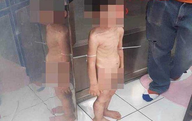 Phẫn nộ cậu bé 3 tuổi bị bố và người tình bạo hành mỗi ngày, đói tới mức phải lấy phân để ăn