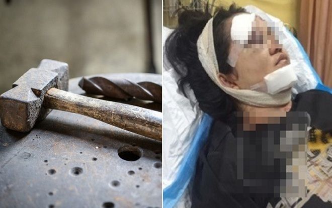 Không tìm được việc sau tốt nghiệp, cha đánh con gái tới nhập viện