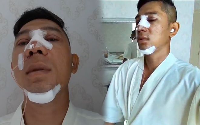 Đập mặt xây lại toàn bộ, hình ảnh mới của Lương Bằng Quang ai cũng phải…choáng!