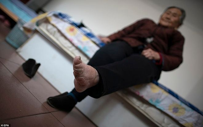 Đôi chân biến dạng cả đời của người phụ nữ cuối cùng theo tục 'bó chân gót sen' ở Trung Quốc