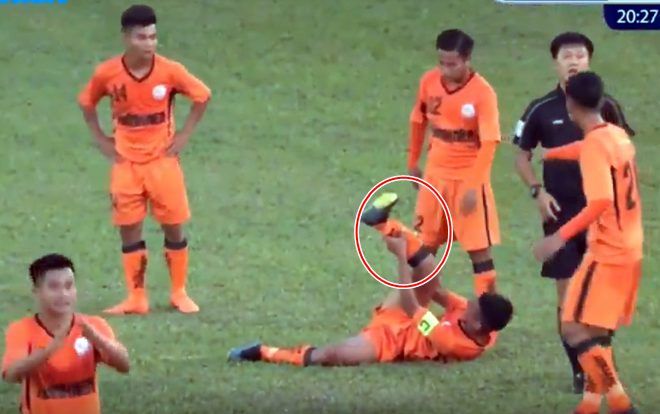 Cầu thủ Đà Nẵng bị gãy chân khó tin trong trận đấu với U19 HAGL