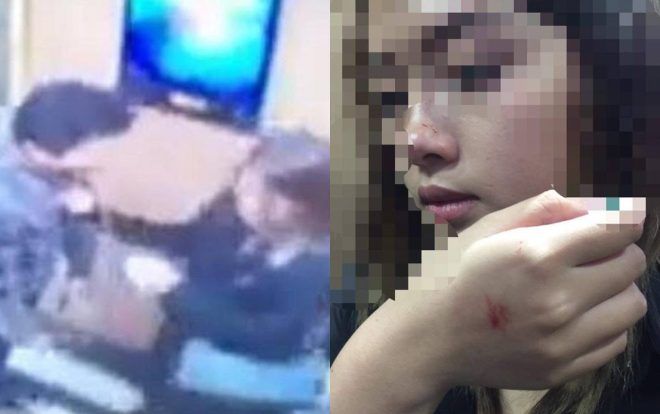 Cô gái bị cưỡng hôn trong thang máy chung cư cao cấp sẽ làm đơn đề nghị khởi tố đối tượng
