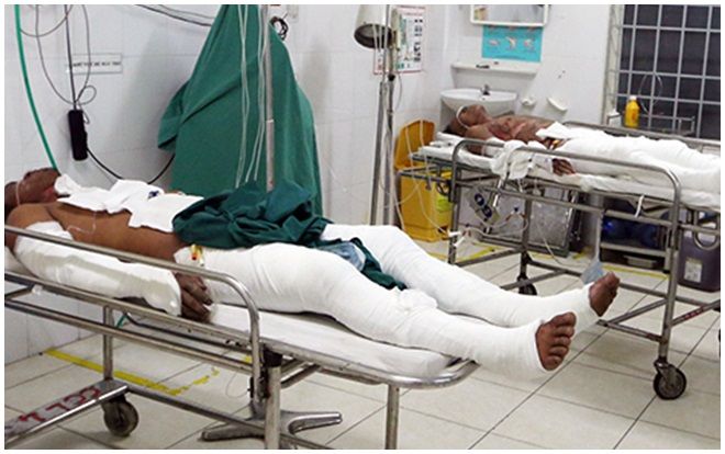 Thách đố nhau ai không uống rượu sẽ bị tạt xăng, 6 thanh niên biến thành 'ngọn đuốc sống'