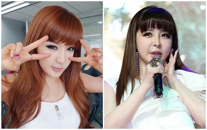 Nghiện phẫu thuật thẩm mỹ khiến gương mặt Park Pom biến dạng đau lòng