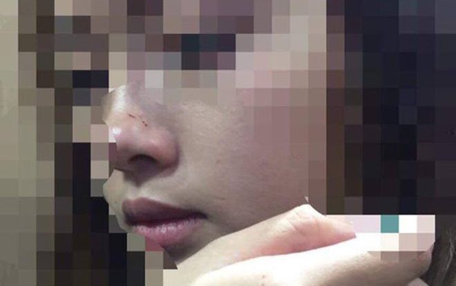 Vụ cô gái bị cưỡng hôn trong thang máy chung cư cao cấp: Sẽ công khai xin lỗi tại tòa nhà