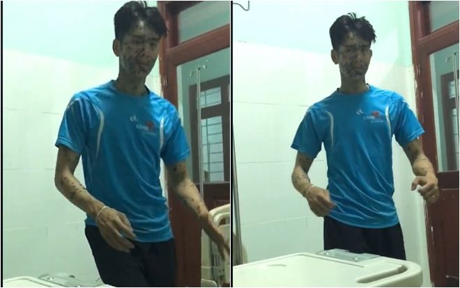 Chết cười clip bệnh nhân bị thủy đậu nặng phải nhập viện vẫn còn tâm trạng nhảy theo nhạc để… đỡ ngứa