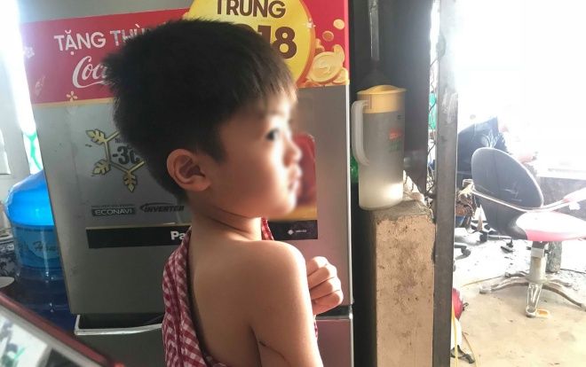 Bé trai 6 tuổi từng bị đàn chó dữ cắn thoát chết: 'Hôm đó cháu bị ngã nằm xuống đất nên chỉ bị cào vào tay, cắn vào mông'