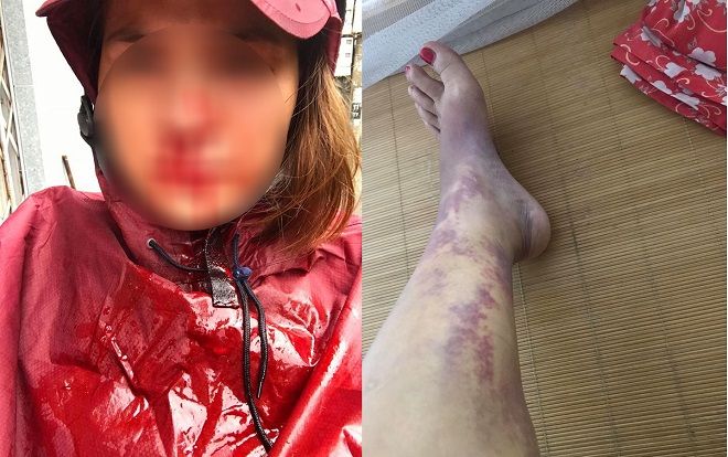 Tâm thư đẫm nước mắt của người vợ cùng nhau vượt qua lúc cơ hàn, đến khi giàu sang chồng lại đánh đập ngoại tình khiến nhiều người bật khóc