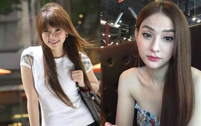 Thu Thủy đính chính là sửa mũi để làm đẹp nhưng liệu có đẹp?