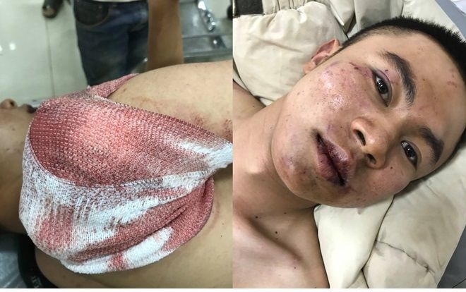 Đi đòi nợ, thanh niên 9X bị chém tới tấp phải nhập viện trong tình trạng nguy kịch