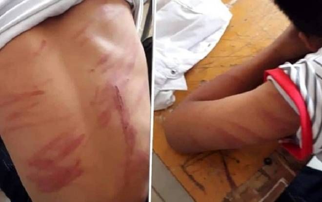 Vụ bé trai bị bố ruột bạo hành đến mức ngất xỉu, nhập viện: 'Ông ấy đánh cháu hơn 30 phút'