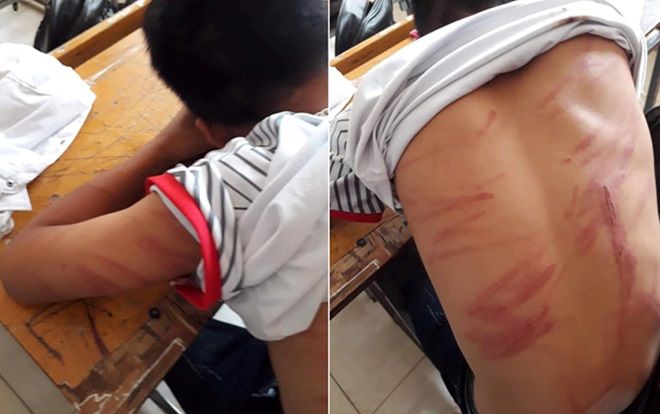 Người bố đánh con ngất xỉu phải nhập viện khai gì tại cơ quan công an?