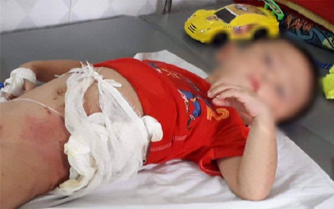 Xin miếng dưa chuột cũng không được, cậu ruột ném cháu 5 tuổi vào đống lửa