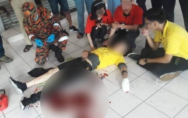 Cặp đôi bị người đàn ông lạ đâm chém dã man khi đang chụp ảnh tự sướng vì lý do ngớ ngẩn này