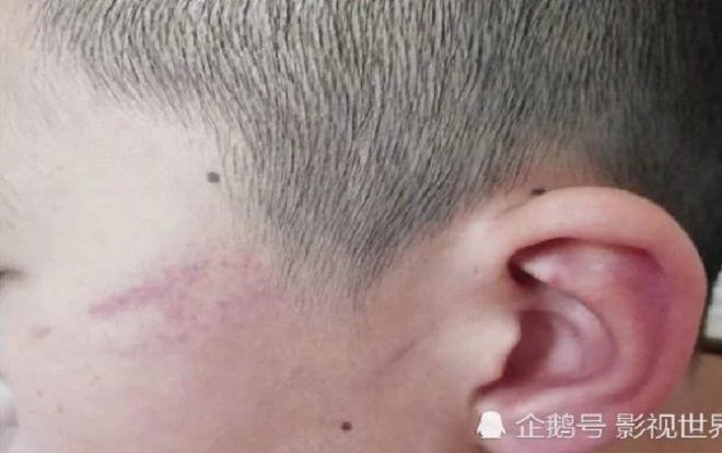 Không trả lời được câu hỏi, học sinh bị giáo viên tát gần 100 cái vào mặt tới mức nhập viện