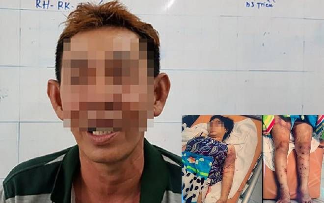 Vụ thai phụ bị tra tấn dã man suốt 20 ngày đến sẩy thai: Cha nạn nhân tiết lộ sự thật số tiền nợ một triệu mấy…