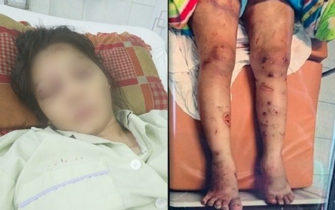 Thai phụ 6 tháng bị 'bắt cóc', tra tấn suốt 20 ngày đến sẩy thai: Chỉ vì món nợ 1 triệu 6 của anh trai