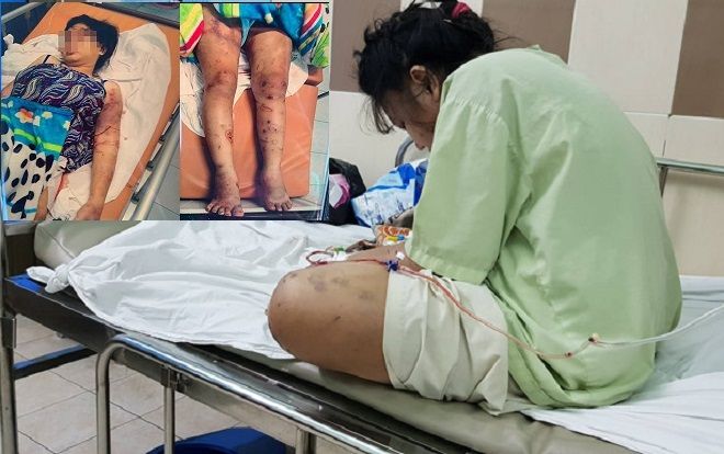 22 ngày địa ngục của bà bầu bị 'bắt cóc', tra tấn đến sẩy thai: Ép 'chơi' ma túy, dùng ná bắn vào vùng kín