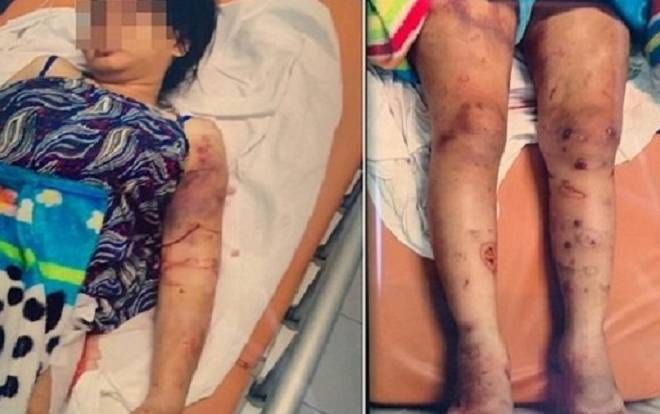 Khởi tố, bắt tạm giam đối tượng tham gia 'bắt cóc', đánh đập bà bầu suốt 20 ngày dẫn đến sảy thai