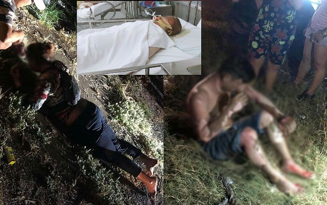 Nghi án vợ dùng xăng đốt chồng rồi tự thiêu: Người chồng liên tục gọi tên, hỏi thăm vợ