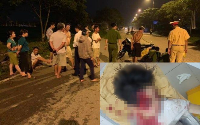 Bé trai nghi bị ô tô kéo lê hơn 100m, cơ thể trầy xây xát nặng