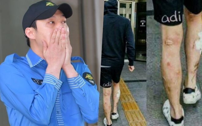 Park Yoochun tiếp tục bị netizen 'đào bới' những bức ảnh 'lở loét' chân tay sau khi có kết quả thử nghiệm dương tính với ma túy