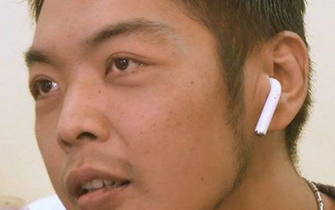 Nuốt nhầm tai nghe lúc ngủ, thanh niên tỉnh dậy tá hỏa thấy bụng phát nhạc rè rè