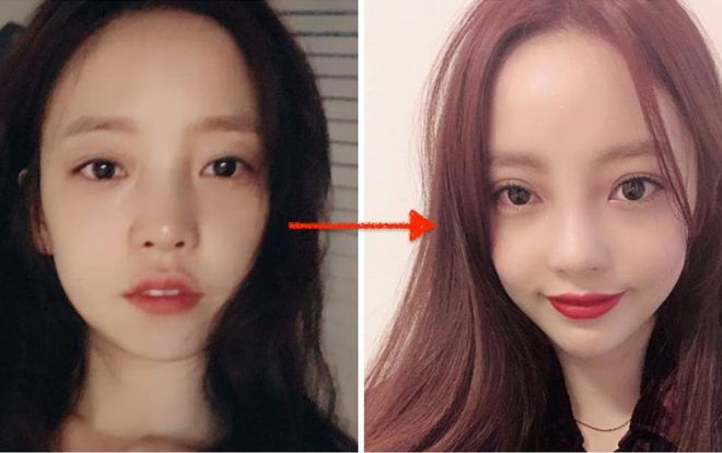 Vượt thác scandal ngoạn mục, Goo Hara mạnh tay phẫu thuật thẩm mĩ thay đổi diện mạo