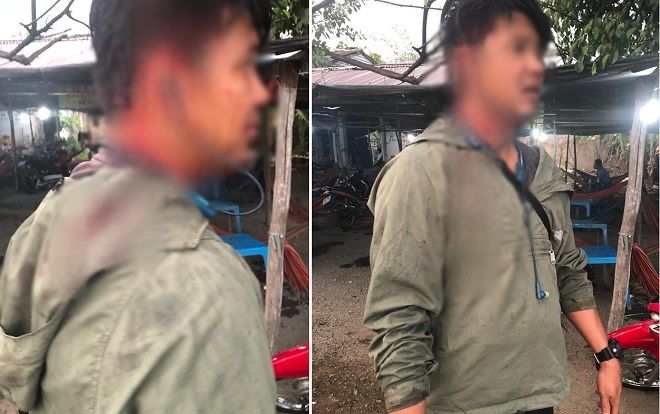 Chủ quán đánh khách đổ máu vì thắc mắc tô hủ tiếu 100.000 đồng: Gọi anh ruột và các con ra vây đánh hội đồng