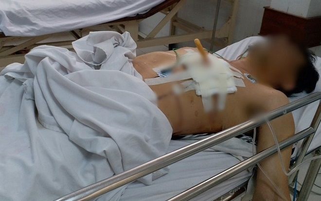 Cứu sống người đàn ông bị trầm cảm tự lấy dao đâm thấu tim mình