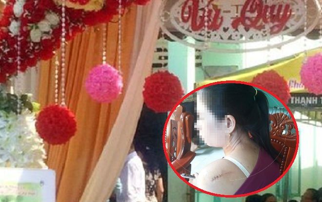 Cô dâu bàng hoàng kể lại giây phút bị chồng cũ xông vào chém tới tấp trong ngày cưới