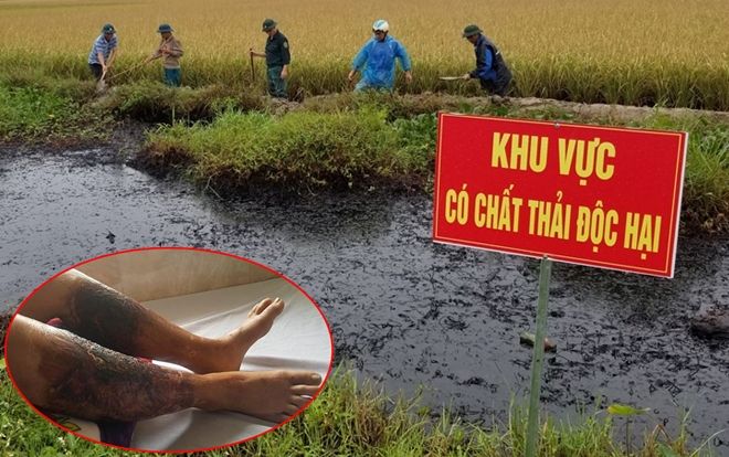 Hải Phòng: Truy tìm đối tượng đổ trộm chất thải độc ra mương nước khiến một người dân bị bỏng nặng