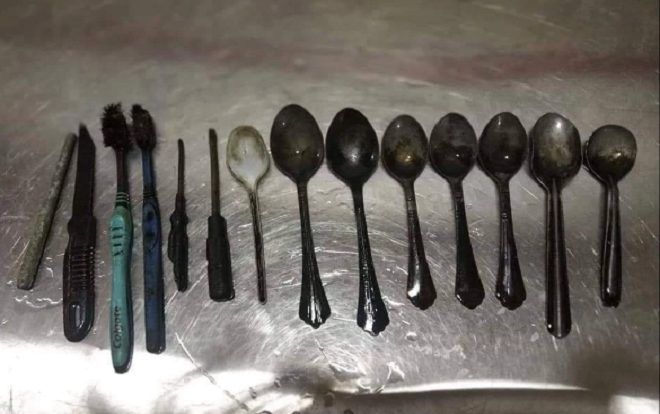 Phàn nàn về cơn đau bụng, bác sĩ choáng váng khi lấy ra 14 vật thể trong bụng người đàn ông