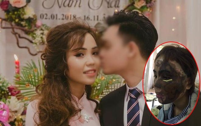 Vụ Thiếu úy Công an tạt axit vợ sắp cưới vì ghen tuông: Mua axit can loại 30 lít để gây án