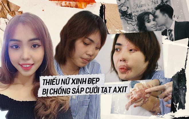 Cô gái xinh đẹp bị chồng sắp cưới là thiếu úy Công an tạt axit: 'Tôi từng bi quan nghĩ mình mất hết tất cả, chữa xong sẽ lên chùa đi tu'