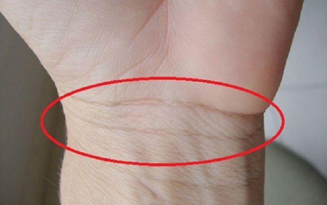 Dành 1 phút xem ngấn cổ tay đoán ngay tương lai sang hèn, sức khỏe mạnh hay yếu