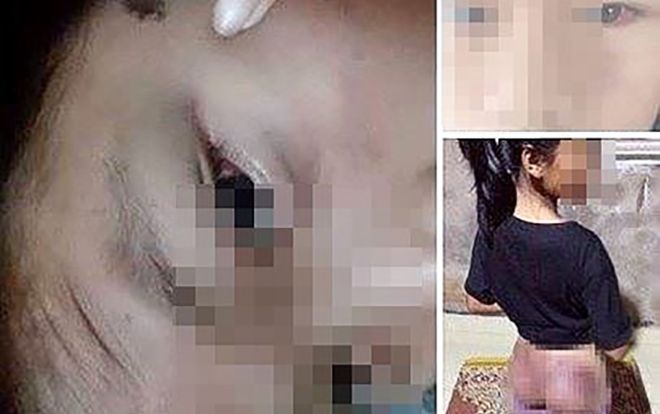 Công an viên đánh bé gái 12 tuổi tím người vì nghi trộm 50.000 đồng