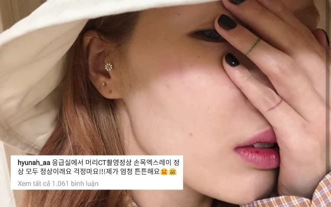 HyunA trấn an fan sau cú ngã trời giáng trên sân khấu: 'Tôi đã chụp CT đầu, quét X-Quang cổ tay,… mọi thứ rất ổn'