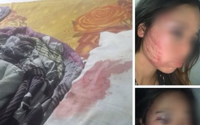 Xót xa lời 'cầu cứu' của người vợ mang bầu 7 tháng, vừa mới chịu tang cha đã bị chồng đánh bầm dập vì say rượu