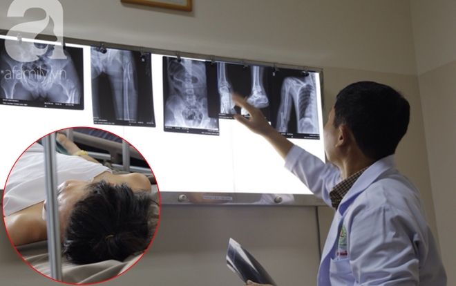 Gia đình ngăn cản không cho 'lấy chồng', thanh niên liền nhảy từ lầu 4 chung cư dẫn đến đa chấn thương