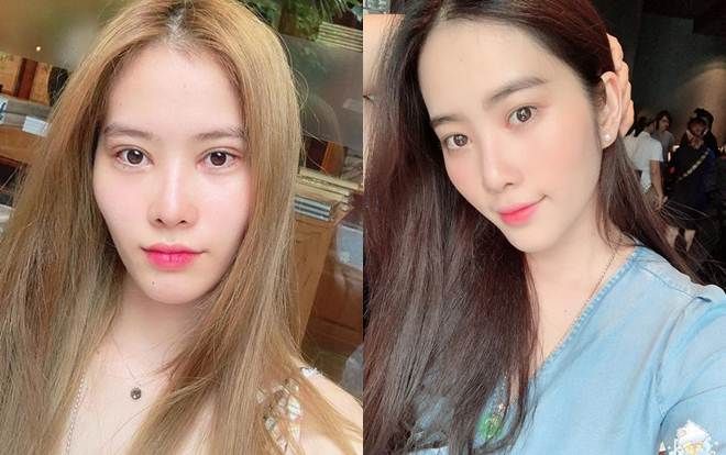 Lần đầu can thiệp dao kéo, Nam Em bị nhận xét không đẹp mà còn hốc hác hơn