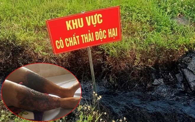 Xác định đối tượng đổ trộm chất thải độc ra mương nước khiến một phụ nữ bị bỏng nặng