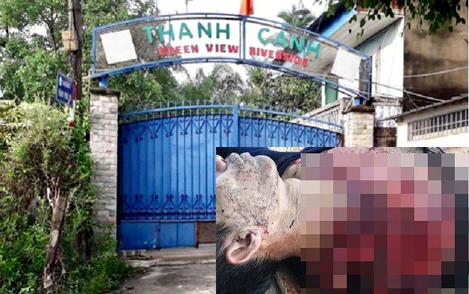 Hổ cắn đứt lìa hai tay người đàn ông trong khu du lịch tại Bình Dương