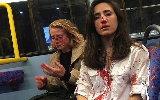 Không chịu hôn nhau trên xe buýt cho người khác xem, cặp đôi nữ đồng tính bị đánh đập dã man