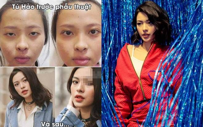 Sau 2 năm đăng quang, Tú Hảo vẫn bị lôi ảnh bị nghi là phẫu thuật thẩm mỹ ra bàn tán