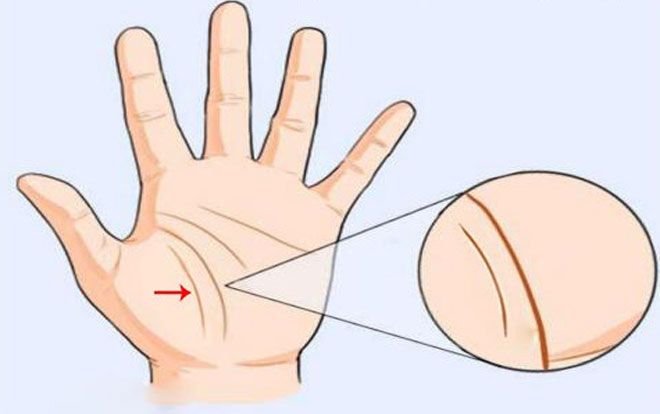 Xem chỉ tay đường sinh mệnh biết ngay người bệnh tật hay khỏe mạnh, ai phúc dày mệnh lớn