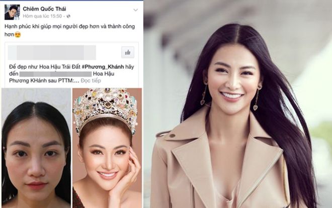 Fan sốc khi biết số lần Hoa hậu Phương Khánh phẫu thuật thẩm mỹ để có nhan sắc nữ thần như hiện tại