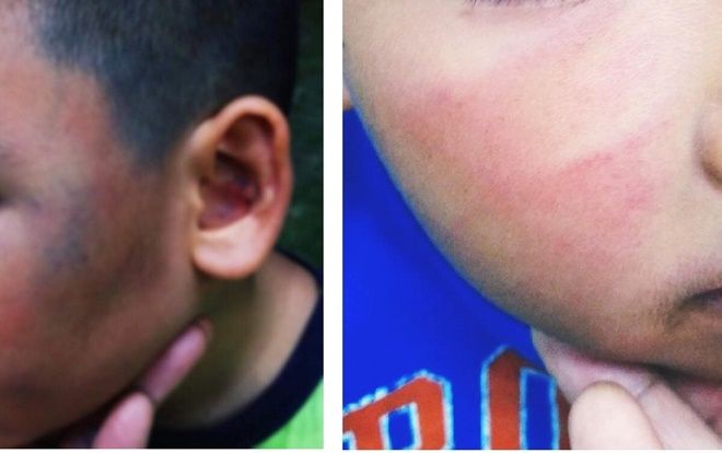 Bé trai 7 tuổi bị đánh chảy máu mũi, đa chấn thương vì nghi trộm gà ở chung cư Sài Gòn, người cha đau đớn viết 'tâm thư' cảnh báo