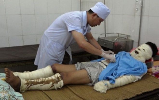 Nổ bình gas trong đám tang, 5 người bị bỏng nặng